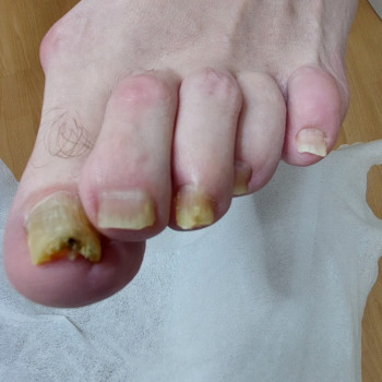 Тетяна Сметанка, Одеса Фото - 18