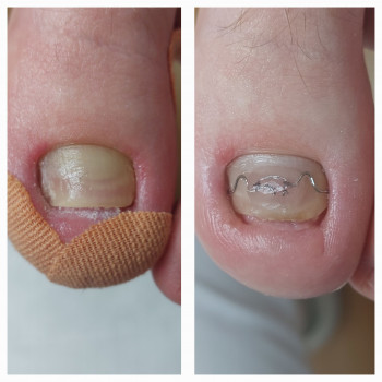 Тетяна Сметанка, Одеса Фото - 19