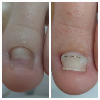 Тетяна Сметанка, Одеса Фото - 20