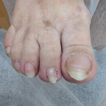 Тетяна Сметанка, Одеса Фото - 22