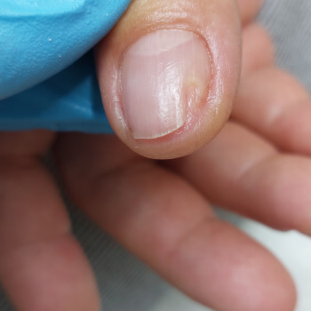 Тетяна Сметанка, Одеса Фото - 24