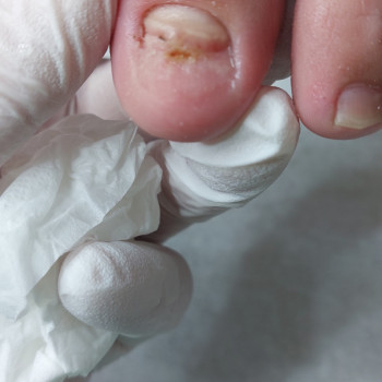 Тетяна Сметанка, Одеса Фото - 26