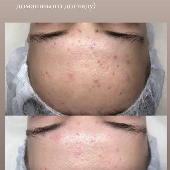 Анастасія Сергеєва, Софіївська Борщагівка Фото - 5