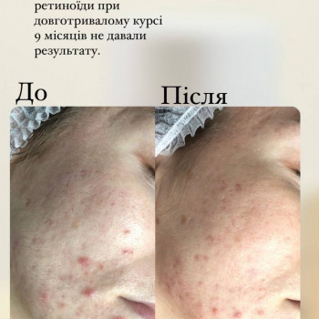 Анастасія Сергеєва, Софіївська Борщагівка Фото - 6