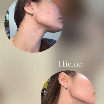 Анастасія Сергеєва, Софіївська Борщагівка Фото - 7