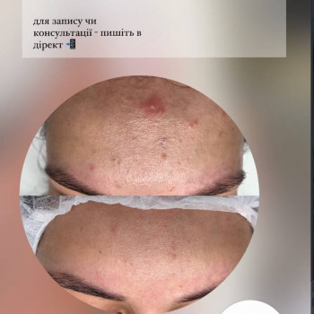 Анастасія Сергеєва, Софіївська Борщагівка Фото - 8