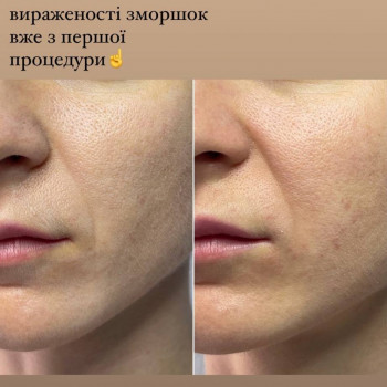 Анастасія Сергеєва, Софіївська Борщагівка Фото - 9