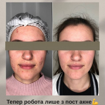 Анастасія Сергеєва, Софіївська Борщагівка Фото - 10