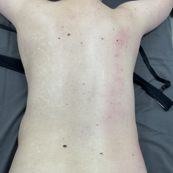 Массаж спины
                    Массажист Вика Одесса