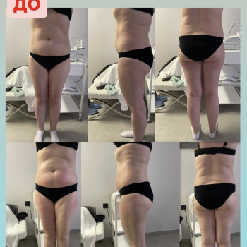 Аппаратный массаж
                    Массажист Вика Одесса