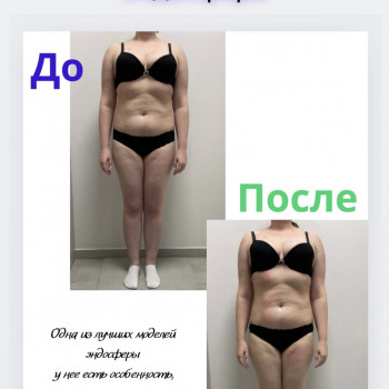 Аппаратный массаж
                    Массажист Вика Одесса