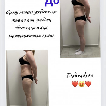 Аппаратный массаж
                    Массажист Вика Одесса