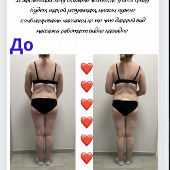 Аппаратный массаж
                    Массажист Вика Одесса