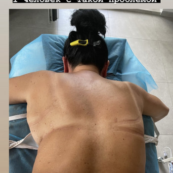 Массаж спины
                    Массажист Вика Одесса