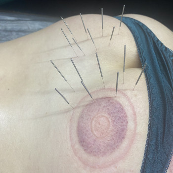 Наталія Іванцова, Одесса Фото - 9