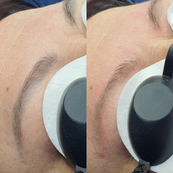 Евгений Рассоха, Кривой Рог Фото - 57