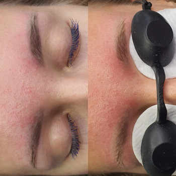 Евгений Рассоха, Кривой Рог Фото - 44