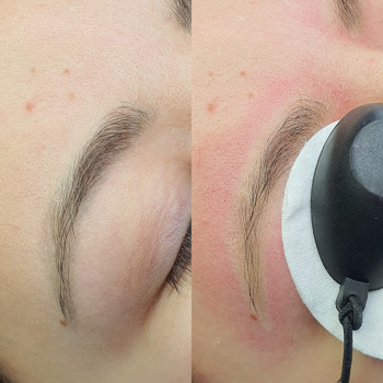 Евгений Рассоха, Кривой Рог Фото - 68