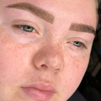 Анна Мекшун, Баштанка Фото - 19