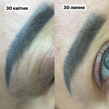 Результат одного видалення