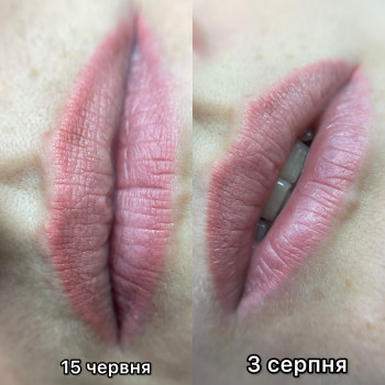 Результат одного видалення, потрібно було прибрати яскравий контур