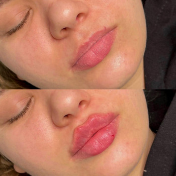 Нонна Корнева, Днепр Фото - 21