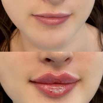 Нонна Корнева, Днепр Фото - 25