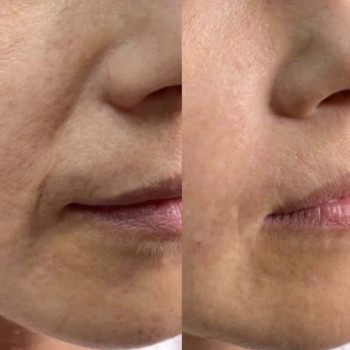 Нонна Корнева, Днепр Фото - 29