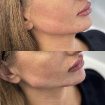 Нонна Корнева, Днепр Фото - 30