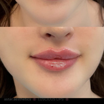 Нонна Корнева, Днепр Фото - 33