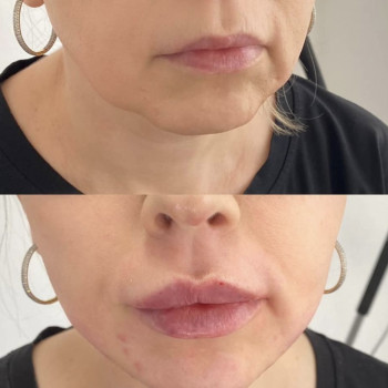 Нонна Корнева, Днепр Фото - 35