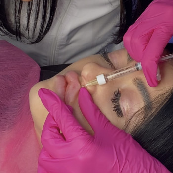 Нонна Корнева, Днепр Фото - 8