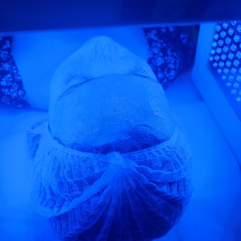 Высокотехнологичный anti age гидрогелевый уход от la pinata stem cells
                    Косметолог Дарья Одесса