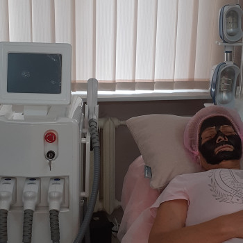 Підготовка до процедури
Карбоновый пілінг