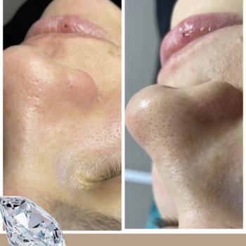 Христина Чорній, Тернополь Фото - 9