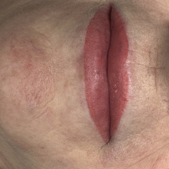 Помадний ефект на віковій шкірі