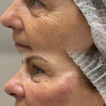 Тетяна Дем'яник, Богородчани Фото - 2