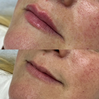 Тетяна Дем'яник, Богородчани Фото - 3