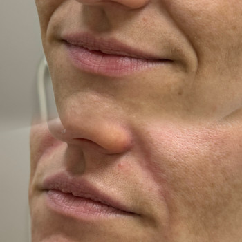 Тетяна Дем'яник, Богородчани Фото - 1