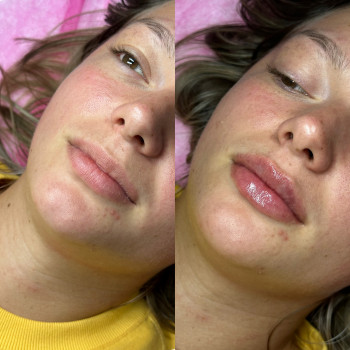 Руслана Мицней, Черновцы Фото - 58