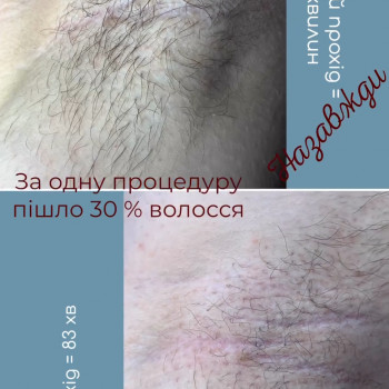 Єлизавета Epil, Київ Фото - 6