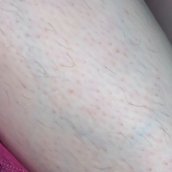 Єлизавета Epil, Київ Фото - 21