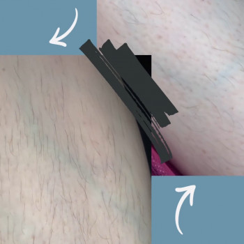 Єлизавета Epil, Київ Фото - 13