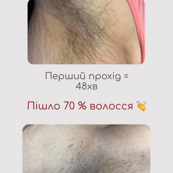 Єлизавета Epil, Київ Фото - 2