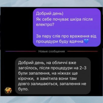 Єлизавета Epil, Київ Фото - 25