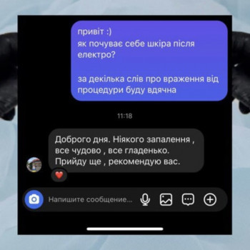 Єлизавета Epil, Київ Фото - 24