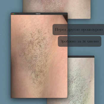 Єлизавета Epil, Київ Фото - 3