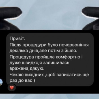 Єлизавета Epil, Київ Фото - 31