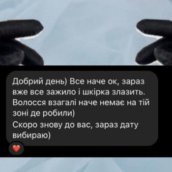 Електроепіляція
                    Майстер депіляції Єлизавета Київ