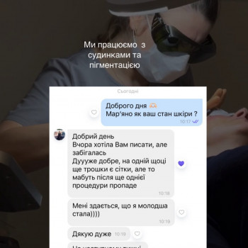 IPL терапія
                    Дерматолог косметолог Марта Львів